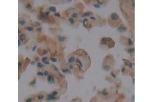 IHC-P analysis of Human Tissue, with DAB staining. (TPSB2 Antikörper  (AA 35-275))