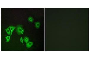 Immunofluorescence analysis of A549 cells, using TTF2 antibody. (TTF2 Antikörper  (Internal Region))