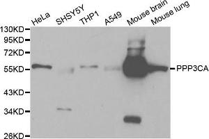 Western blot analysis of extracts of various cell lines, using PPP3CA antibody (ABIN5970422) at 1/1000 dilution. (PPP3CA Antikörper)