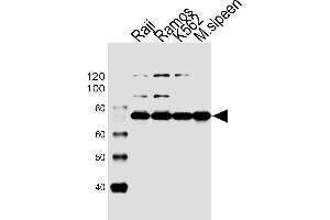Western blot analysis of lysates from Raji, Ramos, K562 cell line and mouse spleen tissue lysate(from left to right), using BTK Antibody (Center) (ABIN6243554 and ABIN6577451). (BTK Antikörper  (AA 396-430))