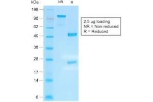 SDS-PAGE Analysis Purified IgG4 Recombinant Rabbit Monoclonal Antibody (IGHG4/2042R). (Rekombinanter IGHG4 Antikörper)