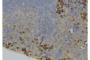 ABIN6273660 at 1/100 staining Human lymph node tissue by IHC-P. (IL-6 Receptor Antikörper  (N-Term))