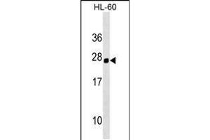 Western blot analysis in HL-60 cell line lysates (35ug/lane). (Homeobox C5 Antikörper  (C-Term))