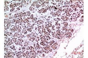 Immunohistochemistry (IHC) analysis of paraffin-embedded Human Pancreas, antibody was diluted at 1:100. (KLF13 Antikörper)