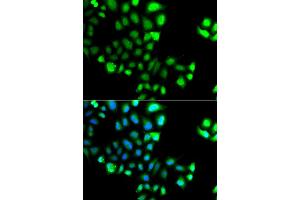 Immunofluorescence analysis of A549 cell using SUMO4 antibody. (SUMO4 Antikörper)