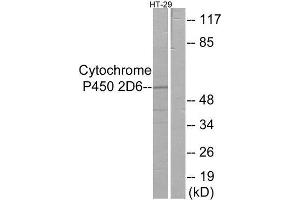 Western Blotting (WB) image for anti-Cytochrome P450, Family 2, Subfamily D, Polypeptide 6 (CYP2D6) (Internal Region) antibody (ABIN1850356) (CYP2D6 Antikörper  (Internal Region))