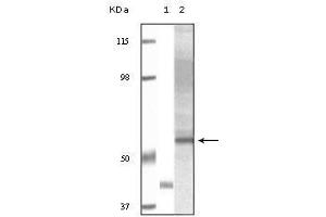 Western Blot showing Akt3 antibody used against truncated Akt3 recombinant protein (1) and human ovary carcinoma tissue lysate (2). (AKT3 Antikörper)