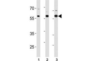 p65 antibody western blot analysis in (1) SK-BR-3, (2) mouse Neuro-2a cell line and (3) mouse testis tissue lysate.