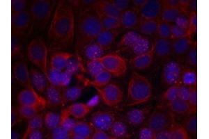 Immunofluorescence staining of methanol-fixed MCF cells using HER2(Phospho-Tyr1221/Tyr1222) Antibody. (ErbB2/Her2 Antikörper  (pTyr1221, pTyr1222))