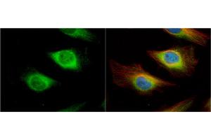 ICC/IF Image Creatine kinase (brain) antibody [N1C1] detects Creatine kinase (brain) protein at cytoplasm and nucleus by immunofluorescent analysis. (CKB Antikörper)