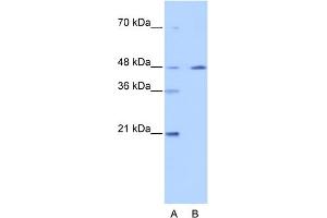WB Suggested Anti-NR2F2 Antibody Titration: 0.