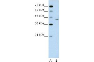 WB Suggested Anti-LRP2BP Antibody Titration:  0. (LRP2BP Antikörper  (Middle Region))