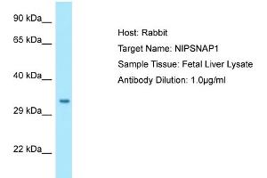 Western Blotting (WB) image for anti-4-Nitrophenylphosphatase Domain and Non-Neuronal SNAP25-Like Protein Homolog 1 (NIPSNAP1) (C-Term) antibody (ABIN2790155) (NIPSNAP1 Antikörper  (C-Term))