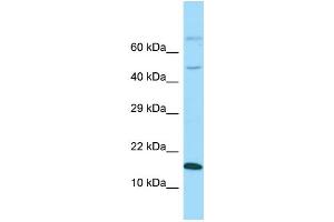 Western Blotting (WB) image for anti-GABA(A) Receptor-Associated Protein Like 1 (GABARAPL1) (Middle Region) antibody (ABIN2774240) (GABARAPL1 Antikörper  (Middle Region))