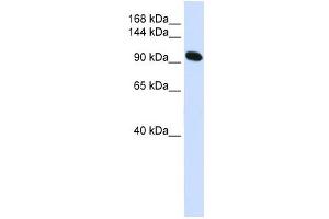 Alpha Actinin 2 antibody used at 1 ug/ml to detect target protein. (ACTN2 Antikörper  (N-Term))