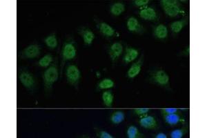 Immunofluorescence analysis of HeLa cells using CPS1 Polyclonal Antibody at dilution of 1:100 (40x lens). (CPS1 Antikörper)