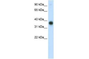 E2F3 antibody used at 0. (E2F3 Antikörper  (C-Term))