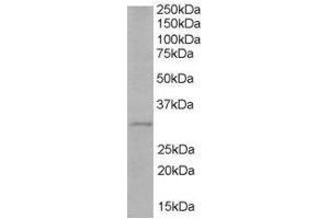 Image no. 1 for anti-Toll-Interleukin 1 Receptor (TIR) Domain Containing Adaptor Protein (TIRAP) (C-Term) antibody (ABIN374117) (TIRAP Antikörper  (C-Term))