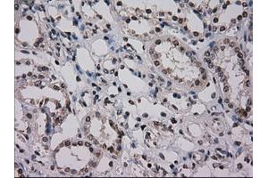 Immunohistochemical staining of paraffin-embedded Kidney tissue using anti-NRBP1mouse monoclonal antibody.