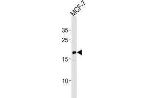 Western Blotting (WB) image for anti-GTPase NRas (NRAS) antibody (ABIN3003468) (GTPase NRas Antikörper)