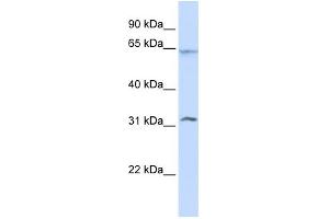 WB Suggested Anti-METT10D Antibody Titration:  0. (METTL16 Antikörper  (N-Term))
