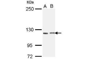 WB Image Sample (30 ug of whole cell lysate) A: H1299 B: Raji 5% SDS PAGE antibody diluted at 1:1000 (IGSF3 Antikörper)