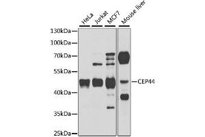 Western blot analysis of extracts of various cell lines, using CEP44 antibody. (CEP44 Antikörper)