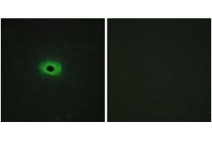 Immunofluorescence analysis of HeLa cells, using TNF12 Antibody. (TWEAK Antikörper  (AA 41-90))