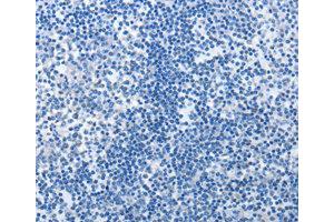 Immunohistochemistry (IHC) image for anti-MutS Homolog 6 (E. Coli) (MSH6) antibody (ABIN1873754) (MSH6 Antikörper)