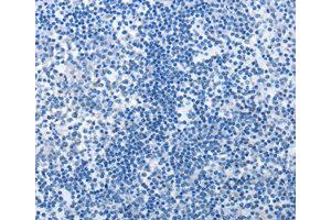 Immunohistochemistry (IHC) image for anti-MutS Homolog 6 (E. Coli) (MSH6) antibody (ABIN1873754) (MSH6 Antikörper)