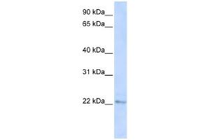 WB Suggested Anti-C6orf64 Antibody Titration:  0. (SAYSD1 Antikörper  (C-Term))