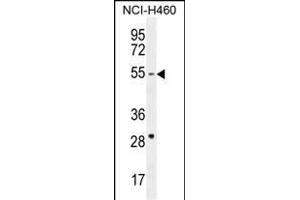 CD2BP2 Antibody (N-term) (ABIN654903 and ABIN2844551) western blot analysis in NCI- cell line lysates (35 μg/lane). (CD2BP2 Antikörper  (N-Term))