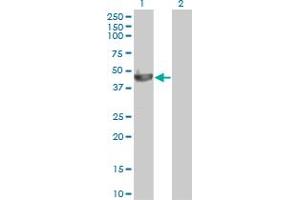 Western Blot analysis of PELO expression in transfected 293T cell line by PELO monoclonal antibody (M03), clone 2C2. (PELO Antikörper  (AA 291-385))