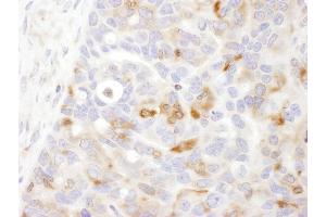 Immunohistochemistry (IHC) image for anti-Bridging Integrator 1 (BIN1) (AA 543-593) antibody (ABIN7454858) (BIN1 Antikörper  (AA 543-593))