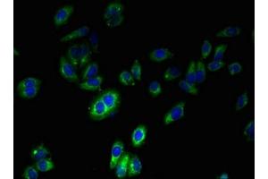 Immunofluorescent analysis of HepG2 cells using ABIN7160754 at dilution of 1:100 and Alexa Fluor 488-congugated AffiniPure Goat Anti-Rabbit IgG(H+L) (FPR2 Antikörper  (AA 307-351))