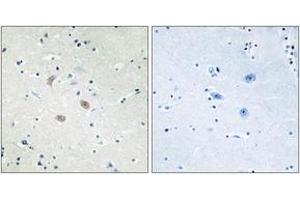 Immunohistochemistry (IHC) image for anti-V-Akt Murine Thymoma Viral Oncogene Homolog 2 (AKT2) (AA 432-481) antibody (ABIN2888944) (AKT2 Antikörper  (AA 432-481))