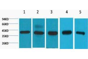 Western Blotting (WB) image for anti-Eukaryotic Translation Initiation Factor 4A1 (EIF4A1) antibody (ABIN3178689) (EIF4A1 Antikörper)