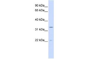INMT antibody used at 1 ug/ml to detect target protein.