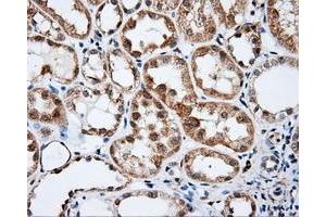 Immunohistochemistry (IHC) image for anti-Bruton Agammaglobulinemia tyrosine Kinase (BTK) antibody (ABIN1496972) (BTK Antikörper)