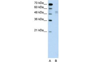 Western Blotting (WB) image for anti-WW Domain Containing E3 Ubiquitin Protein Ligase 2 (WWP2) antibody (ABIN2462664) (WWP2 Antikörper)