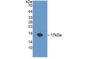 Detection of Recombinant REG1b, Human using Polyclonal Antibody to Regenerating Islet Derived Protein 1 Beta (REG1b) (REG1B Antikörper  (AA 23-166))