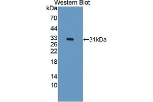 Detection of Recombinant CARD9, Human using Polyclonal Antibody to Caspase Recruitment Domain Family, Member 9 (CARD9) (CARD9 Antikörper  (AA 26-283))