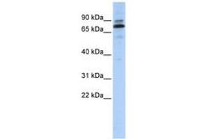 Image no. 1 for anti-Chromosome 14 Open Reading Frame 21 (C14orf21) (AA 215-264) antibody (ABIN6740714) (C14orf21 Antikörper  (AA 215-264))