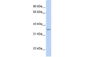 GRHPR antibody used at 1 ug/ml to detect target protein. (GRHPR Antikörper  (N-Term))