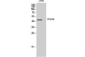 Western Blotting (WB) image for anti-Vacuolar Protein Sorting 26 Homolog B (VPS26B) (Internal Region) antibody (ABIN3177931) (VPS26B Antikörper  (Internal Region))