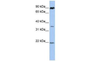 C13ORF7 antibody used at 1 ug/ml to detect target protein. (RNF219 Antikörper  (N-Term))