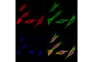 ABIN6259797 and ABIN6277038 staining Hela cells by IF/ICC. (ADH5 Antikörper  (C-Term))