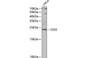 Western blot analysis of extracts of HeLa cells, using SSX2 antibody (ABIN6128794, ABIN6148505, ABIN6148507 and ABIN6222753) at 1:1000 dilution. (SSX2 Antikörper  (AA 1-188))