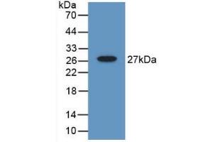 Detection of Recombinant Gelsolin, Mouse using Polyclonal Antibody to Gelsolin (GSN) (Gelsolin Antikörper  (AA 432-625))