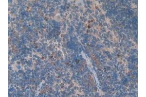 DAB staining on IHC-P; Samples: Rat Spleen Tissue (GDF3 Antikörper  (AA 253-366))